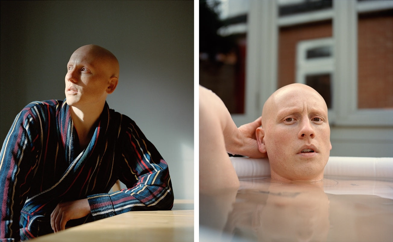 Two images of a person with a bald head; one sitting and one in a hot tub.